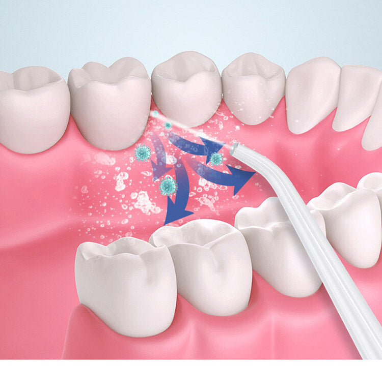 軽量口腔洗浄器 充電式 高速ジェット水流 先端ノズル4種類 水流3段階 口腔ケア 歯間 奥歯 お口の健康 旅行 携帯用(代引不可)