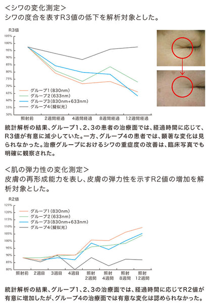美顔 HIGHER DOSE 赤外線フェイスマスク 美白 美容 エステ 美顔器 シミ シワ フェイスマスク 赤外線 ハリ コラーゲン メラニン 代謝促進 自宅エステ(代引不可)
