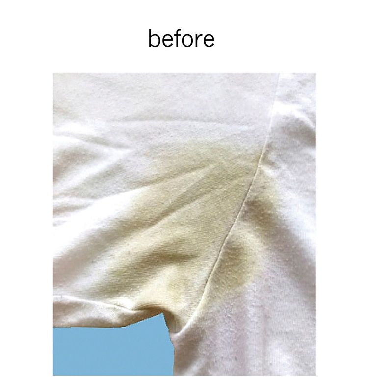 E.OCT プレウォッシュ デオスウェット消臭 DP010010 約 250ml ドイツ製 1本(代引不可)