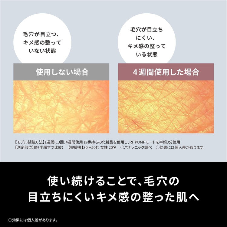 Panasonic バイタリフト EH-SR85-K パナソニック 美顔器 リフトケア 美容器具・美容家電 フェイスライン RF