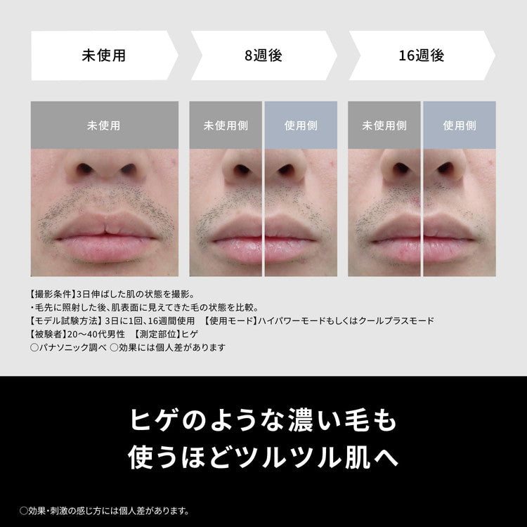 Panasonic ES-WG0B-H 光美容器 パナソニック 脱毛器 光エステ スムースエピ 美容器具 ボディケア パワー&クール 美容家電